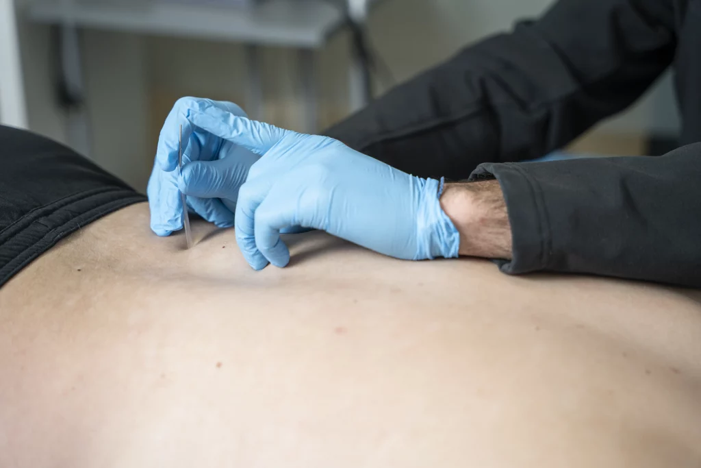 fisioterapia invasiva